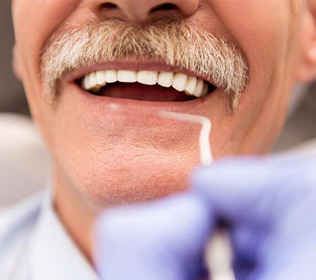 Renton Adjusting to New Dentures