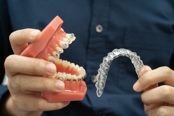 Adjusting To Clear Aligners And How To Stay On Course