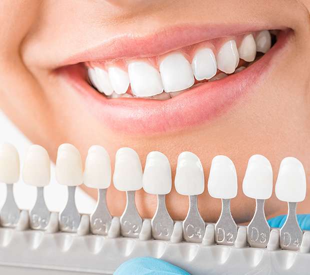 Renton Cosmetic Dentist