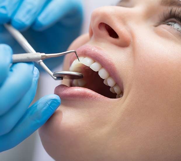 Renton Dental Bonding