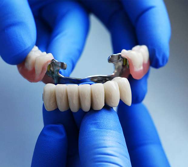 Renton Dental Bridges