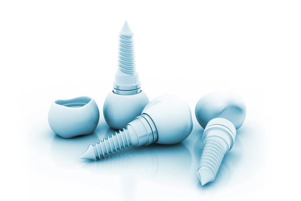 Is Tooth Extraction Necessary Before Receiving Dental Implants?