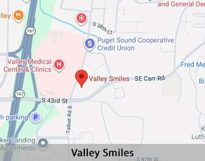Map image for Options for Replacing Missing Teeth in Renton, WA