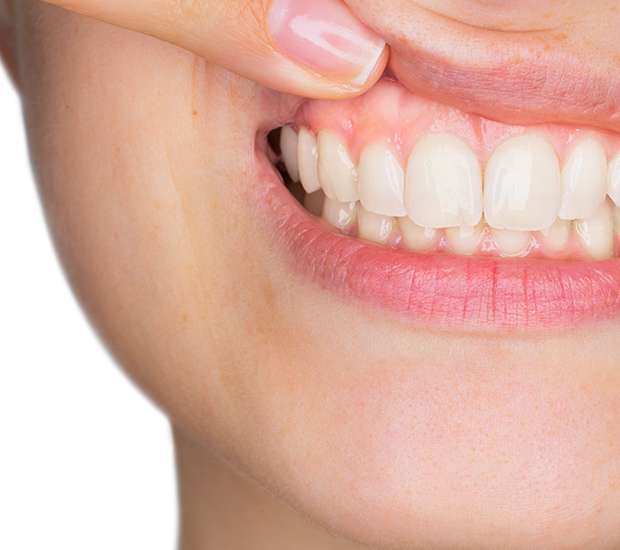Renton Gum Disease