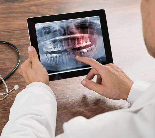 Renton Helpful Dental Information