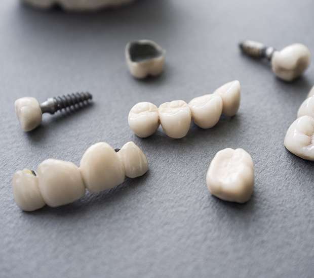 Renton The Difference Between Dental Implants and Mini Dental Implants