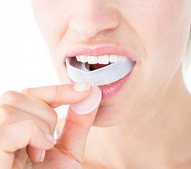 Renton Mouth Guards