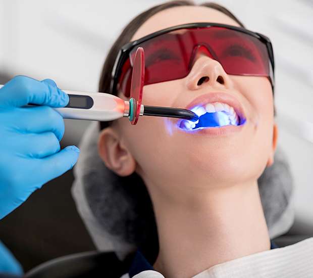 Renton Professional Teeth Whitening