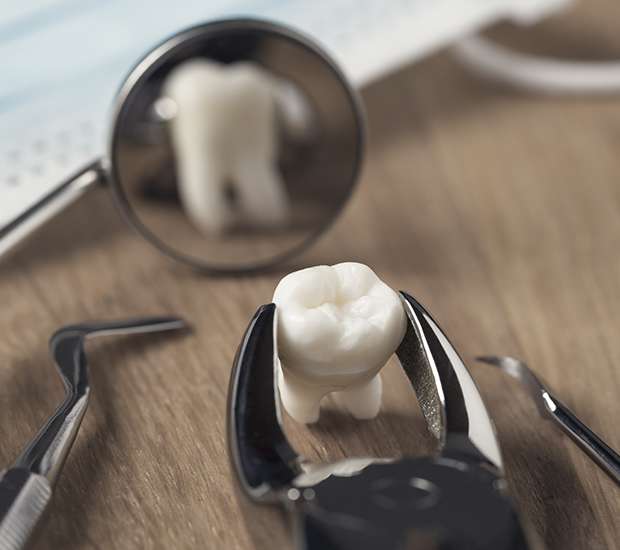 Renton When Is a Tooth Extraction Necessary